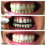 Miracle Teeth - bambusové uhlie na bielenie zubov
