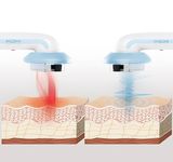 Ultrazvukový kavitačný masážny prístroj proti celulitíde 3v1 s infračerveným žiarením a elektrostimuláciou CELLYMAX